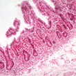 Malabsorpcija (MP 6. del)